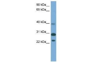 WB Suggested Anti-CCDC28A Antibody Titration: 0. (CCDC28A Antikörper  (Middle Region))