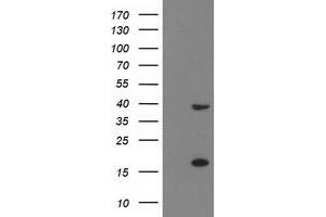 Western Blotting (WB) image for anti-PDZ and LIM Domain 2 (PDLIM2) antibody (ABIN1500125) (PDLIM2 Antikörper)