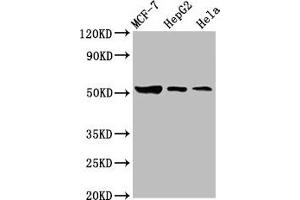 Western Blot Positive WB detected in: MCF-7 whole cell lysate, HepG2 whole cell lysate, Hela whole cell lysate All lanes: GBA antibody at 3. (GBA Antikörper  (AA 215-343))