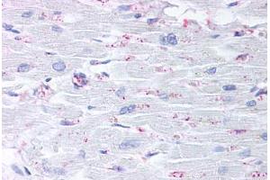 Anti-CYSLTR2 / CYSLT2 antibody  ABIN1048490 IHC staining of human heart. (CasLTR2 Antikörper  (C-Term))