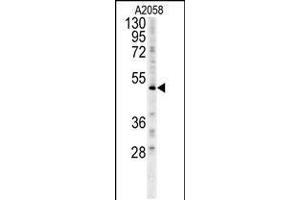 Western blot analysis in A2058 cell line lysates (15ug/lane). (FOXC2 Antikörper  (AA 159-186))