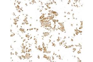 Immunocytochemistry (ICC) image for anti-Metadherin (MTDH) (AA 475-525) antibody (ABIN7795651) (Rekombinanter MTDH Antikörper  (AA 475-525))