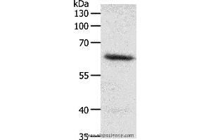 Western blot analysis of Mouse heart tissue, using FZD4 Polyclonal Antibody at dilution of 1:200 (FZD4 Antikörper)