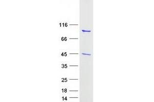 Western Blotting (WB) image for Gelsolin (GSN) (Transcript Variant 1) protein (Myc-DYKDDDDK Tag) (ABIN2721787)