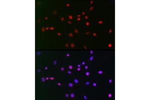 Immunofluorescence (IF) image for anti-C-terminal Binding Protein 2 (CTBP2) antibody (ABIN7265979)