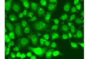 Immunofluorescence analysis of A549 cells using TSEN2 antibody. (TSEN2 Antikörper)