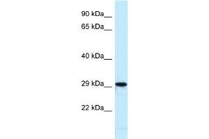 Host:  Rabbit  Target Name:  Nfic  Sample Type:  Mouse Heart lysates  Antibody Dilution:  1. (NFIC Antikörper  (N-Term))