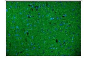 IF analysis of Alpha Internexin/INA using anti-Alpha Internexin/INA antibody (ABIN7602187). (INA Antikörper  (AA 62-169))