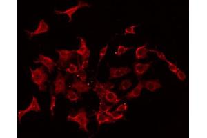 ABIN6267406 staining Hela by IF/ICC. (Stathmin 1 Antikörper  (pSer38))