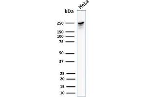 Western Blot Analysis of human HeLa cell lysate using Spectrin beta III Mouse Monoclonal Antibody (SPTBN2/1582). (Spectrin, Beta, Non-erythrocytic 2 (SPTBN2) (AA 356-475) Antikörper)