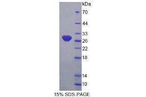 SDS-PAGE analysis of Human FBL Protein. (Fibrillarin Protein (FBL))
