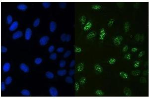 anti-Runt-Related Transcription Factor 3 (RUNX3) (AA 128-270) antibody