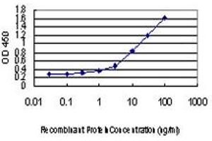 Detection limit for recombinant GST tagged RAD18 is approximately 0. (RAD18 Antikörper  (AA 332-430))