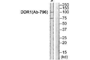 Western blot analysis of extracts from JK cells, using DDR1 (Ab-796) antibody. (DDR1 Antikörper  (Tyr796))