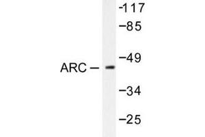 Image no. 2 for anti-Cadherin 1, Type 1, E-Cadherin (Epithelial) (CDH1) (Arg3) antibody (ABIN265314) (E-cadherin Antikörper  (Arg3))