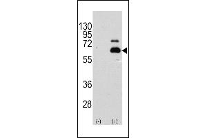 Western blot analysis of RPS6KB1 (arrow) using rabbit polyclonal RPS6KB1 Antibody  (R). (RPS6KB1 Antikörper  (AA 405-434))