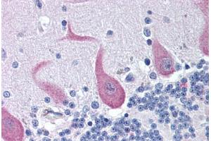 Human Brain, Cerebellum (formalin-fixed, paraffin-embedded) stained with FAIM2 antibody ABIN292115 at 10 ug/ml followed by biotinylated goat anti-rabbit IgG secondary antibody ABIN481713, alkaline phosphatase-streptavidin and chromogen. (FAIM2 Antikörper  (AA 1-50))
