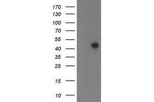 Western Blotting (WB) image for anti-Tropomodulin 1 (TMOD1) antibody (ABIN1501529)