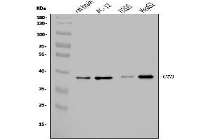 Western blot analysis of Calponin 3/CNN3 using anti-Calponin 3/CNN3 antibody (ABIN7602857).