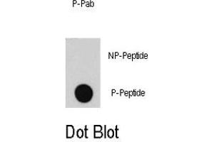Dot blot analysis of E2F1 (phospho S332) polyclonal antibody  on nitrocellulose membrane. (E2F1 Antikörper  (pSer332))
