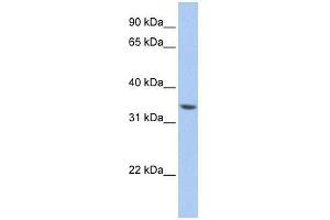 ZNF584 antibody used at 0. (ZNF584 Antikörper  (Middle Region))