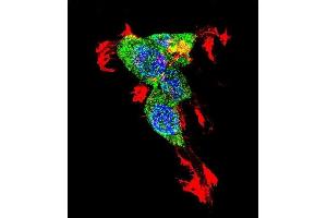 Immunofluorescence (IF) image for anti-Catenin (Cadherin-Associated Protein), beta 1, 88kDa (CTNNB1) (AA 78-106), (N-Term) antibody (ABIN1881239)