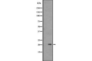 Western blot analysis of PAEP expression in A431 whole cell lysate ,The lane on the left is treated with the antigen-specific peptide. (PAEP Antikörper)