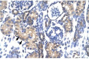 Human kidney; PSMC3 antibody - middle region in Human kidney cells using Immunohistochemistry (PSMC3 Antikörper  (Middle Region))