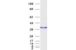 Western Blotting (WB) image for Cell Division Cycle Associated 3 (CDCA3) protein (Myc-DYKDDDDK Tag) (ABIN2713849)
