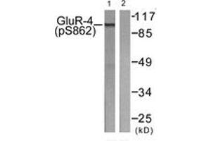 Western blot analysis of extracts from HepG2 cells treated with Forskolin 40nM 30', using GluR4 (Phospho-Ser862) Antibody. (GRIA4 Antikörper  (pSer862))