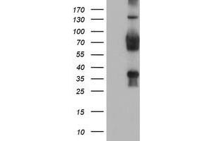 Western Blotting (WB) image for anti-Transducin-Like Enhancer Protein 2 (TLE2) antibody (ABIN1501408) (TLE2 Antikörper)
