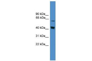 WB Suggested Anti-EIF2AK2 Antibody Titration:  0. (EIF2AK2 Antikörper  (Middle Region))