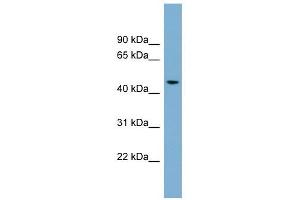 ACTR3B antibody used at 1 ug/ml to detect target protein. (ACTR3B Antikörper)
