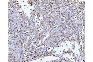 IHC analysis of Vimentin using anti-Vimentin antibody (ABIN3042344).
