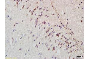 Formalin-fixed and paraffin embedded rat brain labeled with Rabbit Anti-APP/Amyloid Precursor Protein Polyclonal Antibody (ABIN725120) at 1:200 followed by conjugation to the secondary antibody and DAB staining. (APP Antikörper  (AA 381-480))