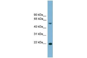 WB Suggested Anti-HDGFRP3 Antibody Titration: 0. (HDGFRP3 Antikörper  (Middle Region))