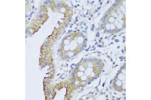 Immunohistochemistry of paraffin-embedded human colon using CRA antibody (ABIN6132087, ABIN6138999, ABIN6139001 and ABIN6217973) at dilution of 1:150 (40x lens). (EFCAB4B Antikörper  (AA 1-200))