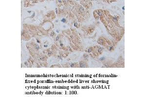 Image no. 1 for anti-Agmatine Ureohydrolase (Agmatinase) (AGMAT) antibody (ABIN1574528) (AGMAT Antikörper)