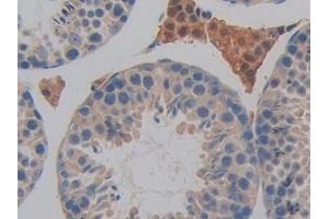 Immunohistochemistry (IHC) image for anti-Dual Adaptor of Phosphotyrosine and 3-phosphoinositides (DAPP1) (AA 1-280) antibody (ABIN7443326)