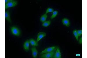 Immunofluorescence staining of HepG2 cells with ABIN7155164 at 1:50, counter-stained with DAPI. (PDE8A Antikörper  (AA 596-829))