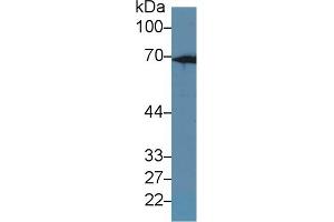 Western Blot; Sample: Rat Liver lysate; Primary Ab: 1µg/ml Rabbit Anti-Rat KRT2 Antibody Second Ab: 0. (Keratin 2 Antikörper  (AA 508-685))