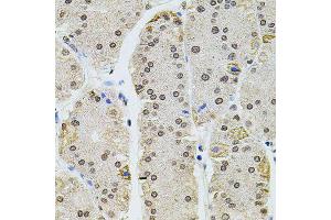 Immunohistochemistry (Paraffin-embedded Sections) (IHC (p)) image for anti-Histone Cluster 1, H2ag (HIST1H2AG) antibody (ABIN3068853)