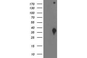 Image no. 2 for anti-DnaJ (Hsp40) Homolog, Subfamily B, Member 2 (DNAJB2) antibody (ABIN1497868) (DNAJB2 Antikörper)