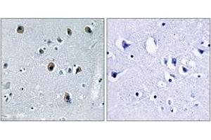 COL20A1 Antikörper  (AA 1151-1200)