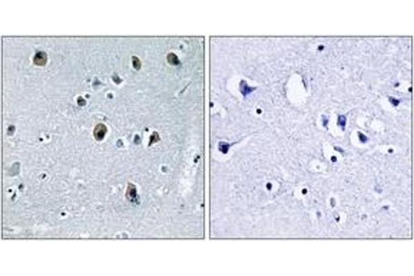 COL20A1 anticorps  (AA 1151-1200)