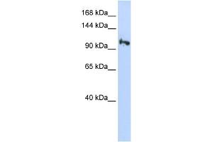 WB Suggested Anti-SMG5 Antibody Titration: 0. (SMG5 Antikörper  (N-Term))