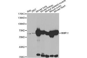 Western blot analysis of extracts of various cell lines, using MMP11 antibody. (MMP11 Antikörper)