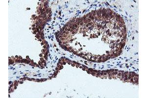 Image no. 1 for anti-Dual Specificity Phosphatase 23 (DUSP23) antibody (ABIN1497930) (DUSP23 Antikörper)