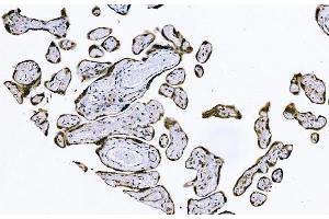 IHC analysis of PIWIL4/PIWI using anti-PIWIL4/PIWI antibody (ABIN7601940). (PIWIL4 Antikörper  (AA 51-749))