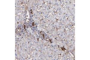 Immunohistochemical staining of human liver with ACTN4 polyclonal antibody  shows strong cytoplasmic and membranous positivity in lymphoid tissue in bile duct cells at 1:1000-1:2500 dilution. (alpha Actinin 4 Antikörper)